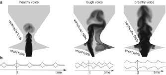 علل ارگانیک و جسمی صدای زیر زنانه در مردان